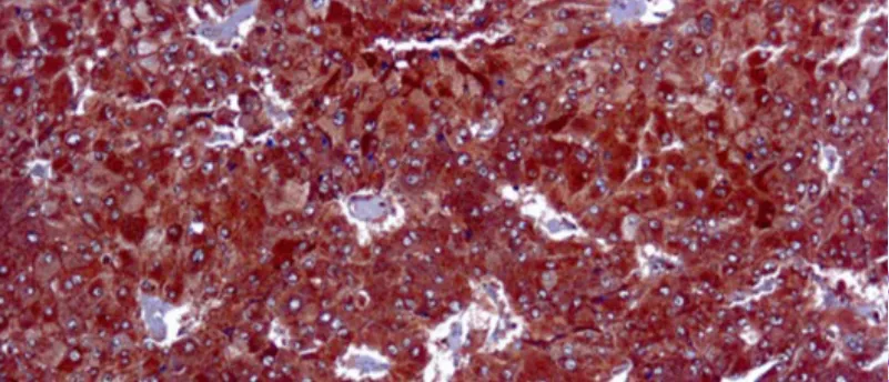 Adipophilin