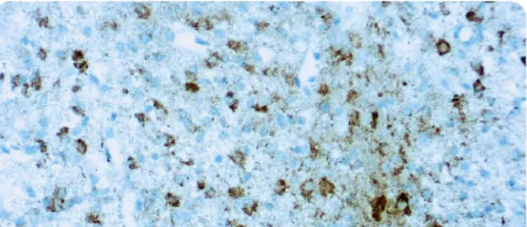 Anti-Isocitrate Dehydrogenase 1 (IDH1)-R132H