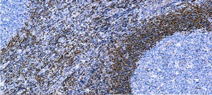 Bcl-2 Onco Proteína