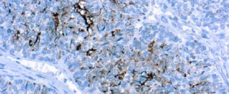 Panel Cervical