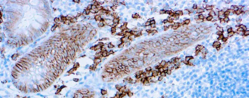 CD138