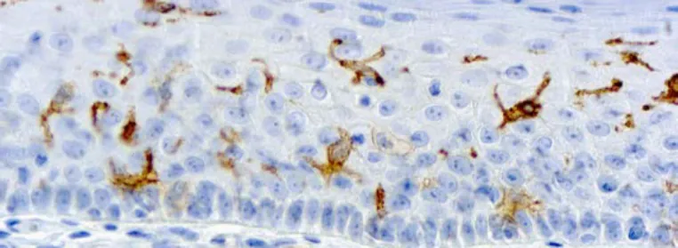 CD1a