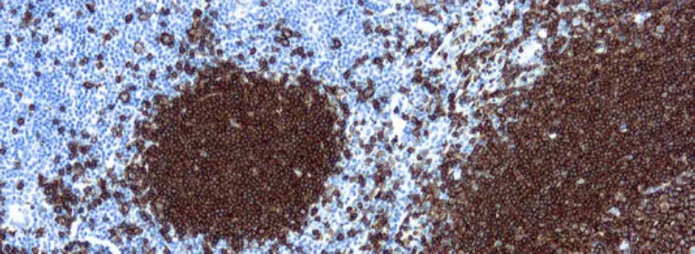 CD20, B-cell (L26)
