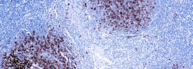 CD23 (SP23)