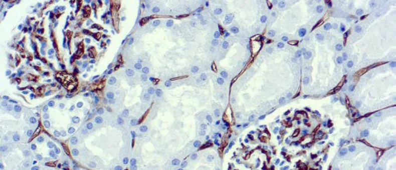 Controles positivos y negativos en inmunohistoquímica