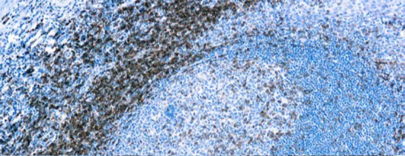 CD4 (EP204)