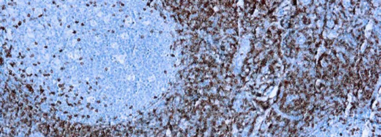Qué significa el clon de un anticuerpo en inmunohistoquímica