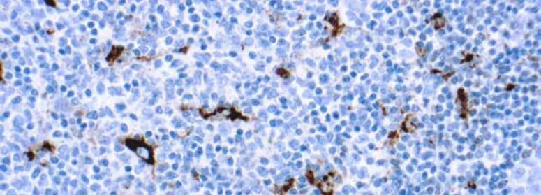 CD68, Macrófago (PG-M1)