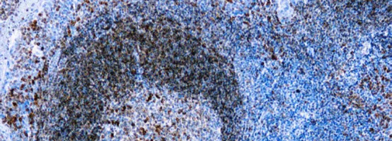 CD79a, B Cell (HM57)