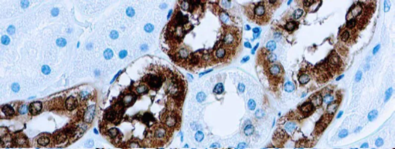 Calbindina-D-28K