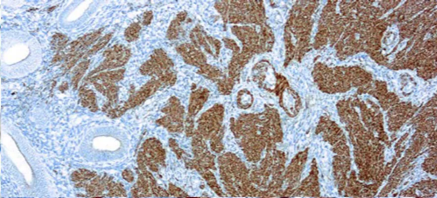 Calponina-1