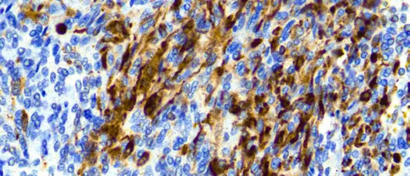 Calretinin (H-5)