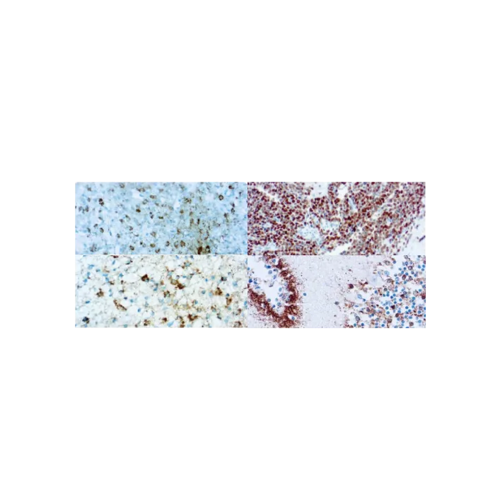 Neuroendocrino