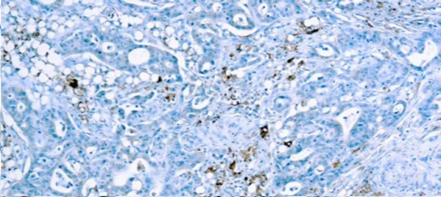 Panel Hormonal