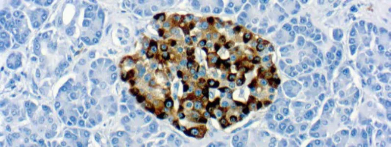 Chromogranin A (LK2H10)