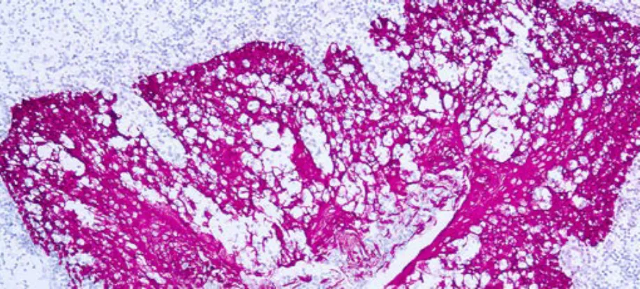 Citoqueratina 8, Bajo Peso Molecular
