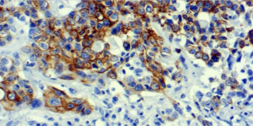 Qué es la inmunohistoquímica y qué permite ver en el tejido