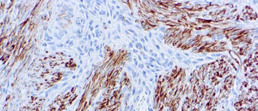 Desmina (D33)