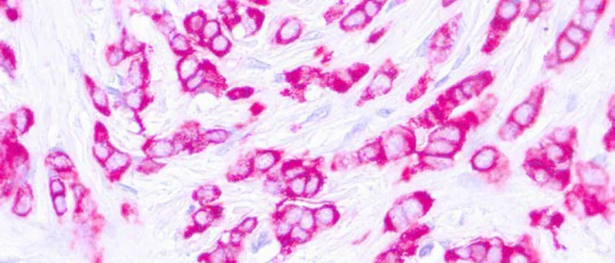 Epithelial Membrane Antigen (EMA) E29