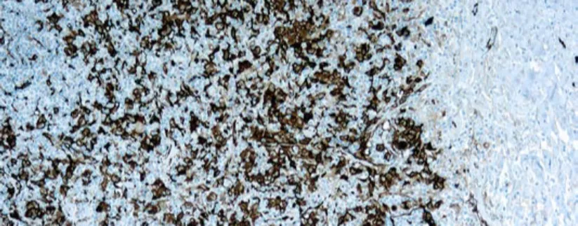 Fascin-1