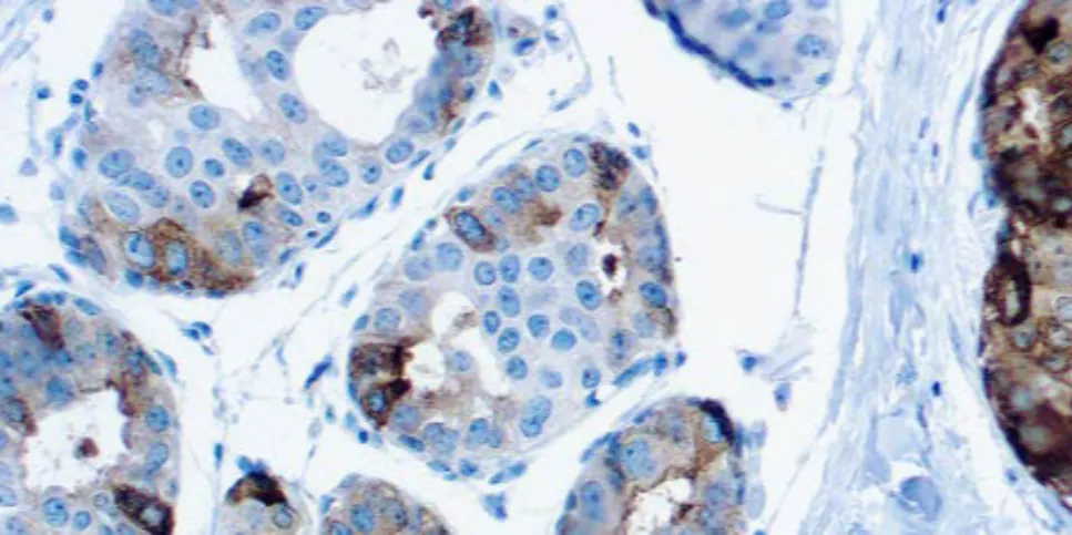 GCDFP-15