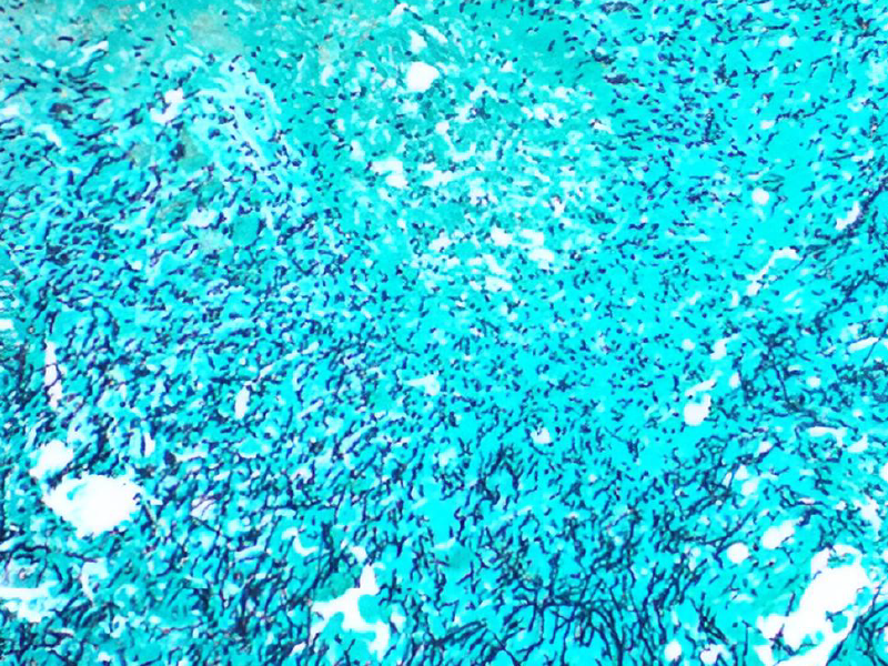 GMS Stain Kit (Grocott)