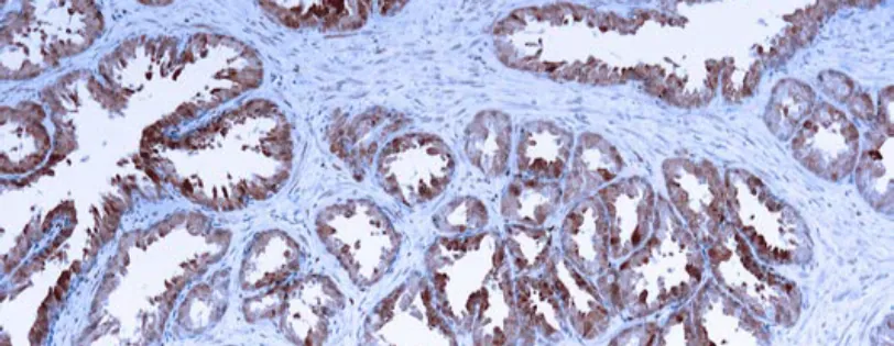 Galectin-3