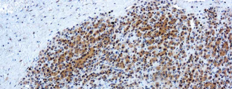 Glypican-3 (GPC3)