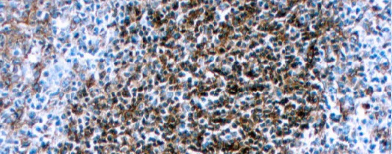 HLA-DR (β chain of DP, DQ & DR)