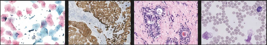 Imágenes digitalizadas de cuatro preparados: citología, inmunohistoquímica, hematoxilina-eosina y frotis sanguíneo