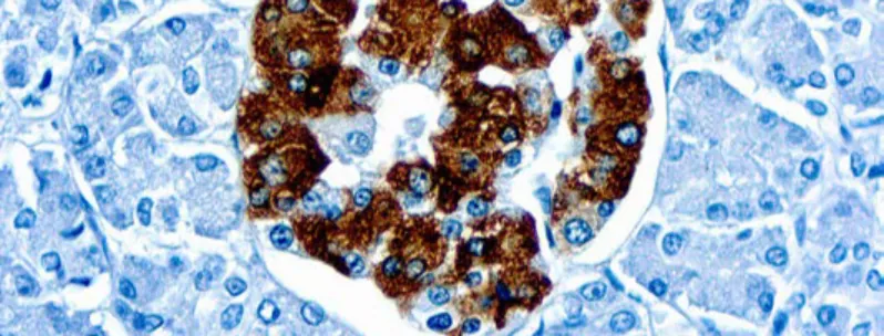 Insulin (K36aC10)