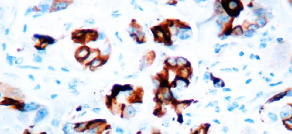 Mammaglobina A