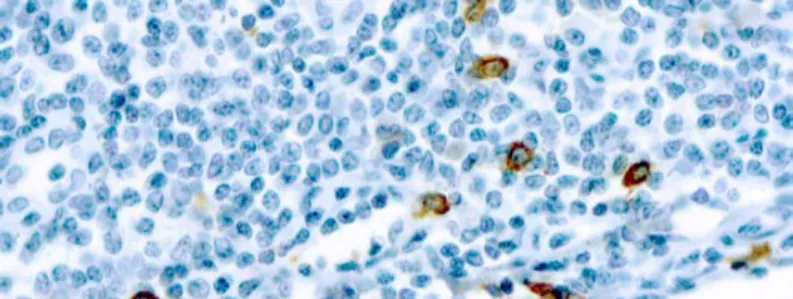Mast Cell Chymase
