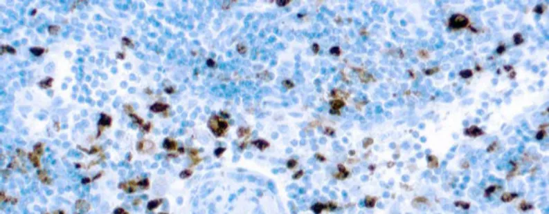 Mieloperoxidasa