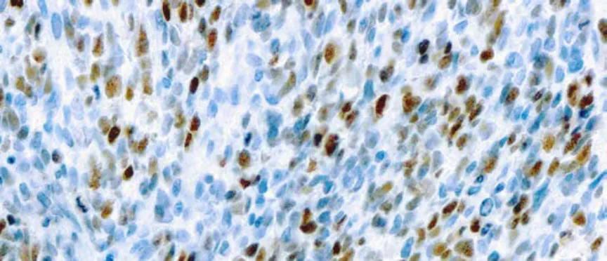 MyoD1 (5.2F)