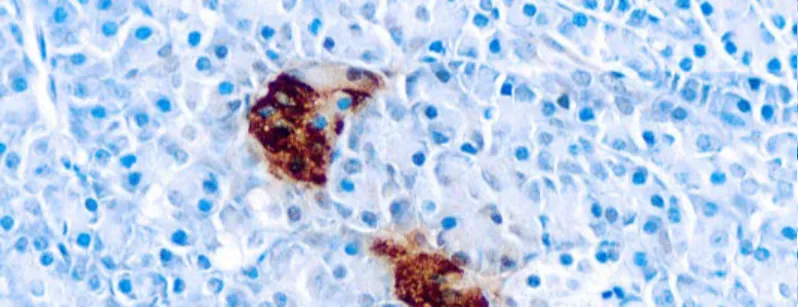 Pancreatic Polypeptide
