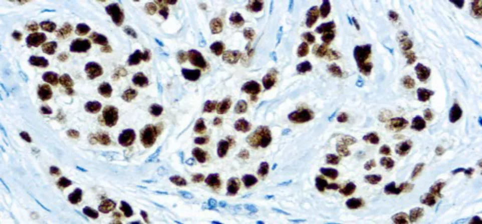 Progesterone Receptor (SP2)