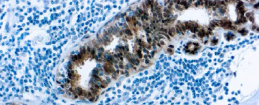 Proteína de Choque Térmico 70 (HSP 70) (W27)