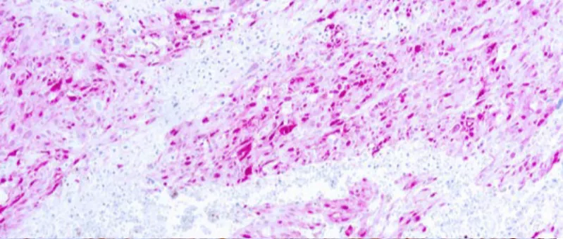 S-100 Protein
