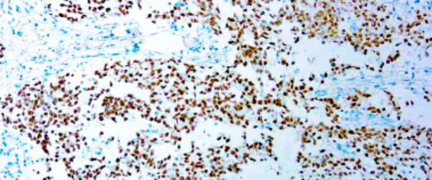 SALL4 (6E3)