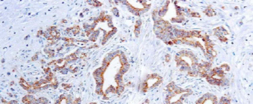 Vascular Endothelial Growth Factor (VEGF) (SP28)