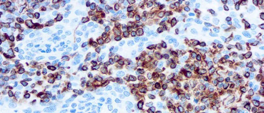 Vimentin, Porcine