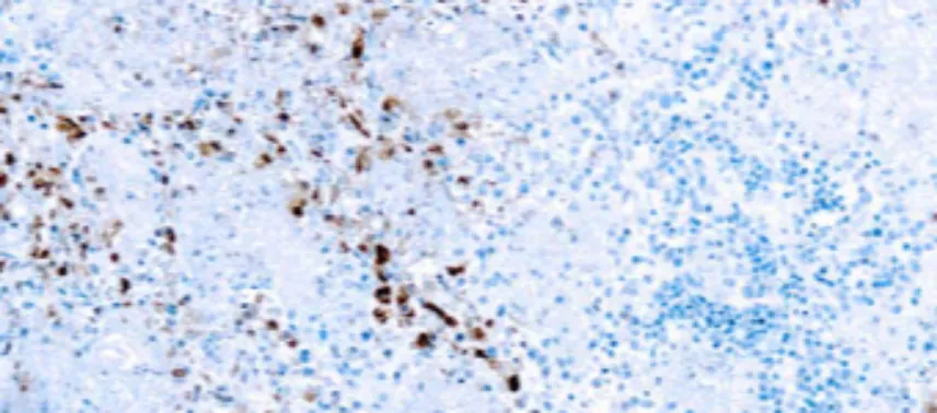 Virus del Herpes Simplex Tipo I (HSV1)