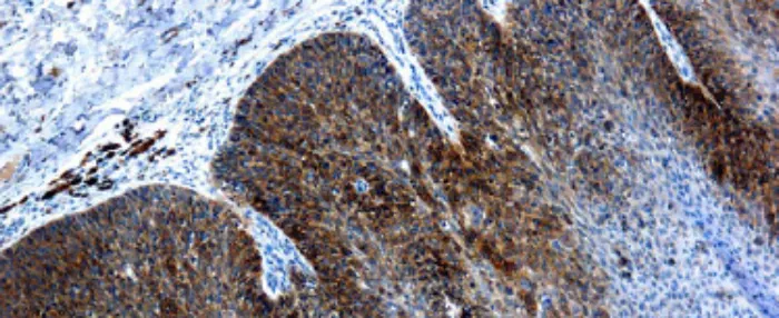 Virus del papiloma humano tipo 16, VPH 16